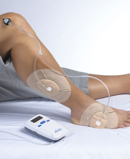 وکیوم تراپی زخم در کرج