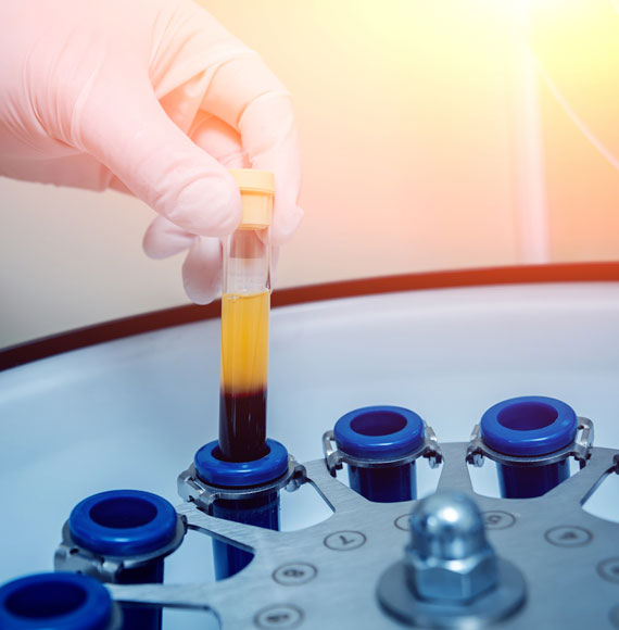 پلاسما تراپی