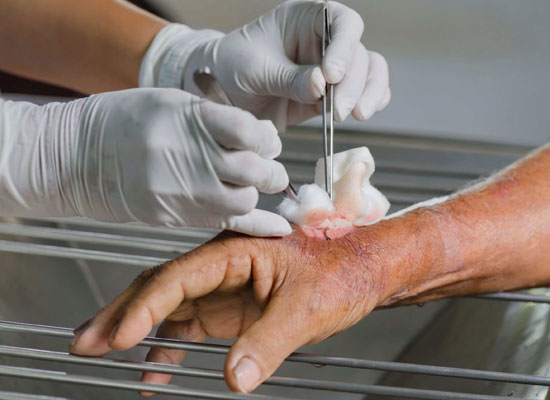 دبریدمان چیست و چرا اهمیت دارد؟