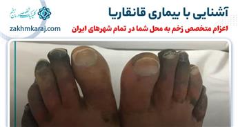 بیماری قانقاریا چیست؟