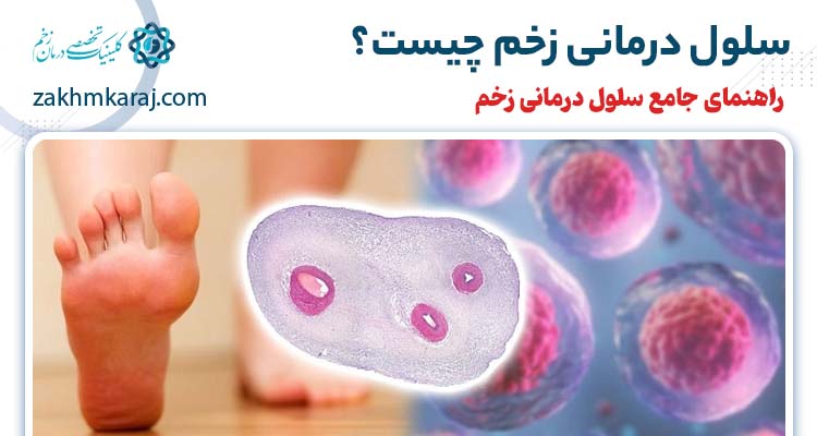 سلول درمانی زخم چیست؟