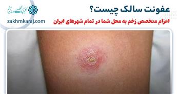 عفونت زخم پشه سالک و روش های درمان آن