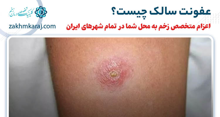 عفونت سالک چیست؟ درمان عفونت زخم پشه سالک