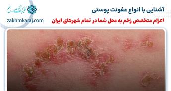 آشنایی با انواع عفونت پوستی
