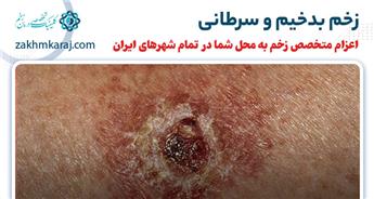زخم بدخیم یا سرطانی چیست و چه انواعی دارد؟