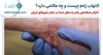 التهاب زخم چیست و چه علائمی دارد؟