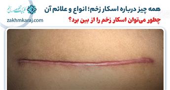 همه چیز درباره اسکار زخم؛ بررسی انواع، علت و روش‌های درمان