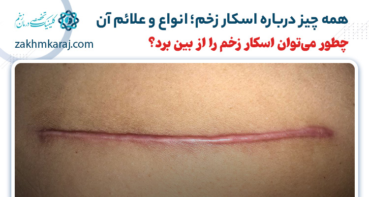 اسکار زخم چیست؟