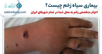 بیماری سیاه زخم چیست؟