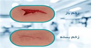 آشنایی با انواع زخم باز و روش های درمان آن