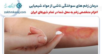درمان زخم های سوختگی ناشی از مواد شیمیایی