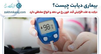بیماری دیابت چیست و چه انواعی دارد؟