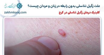 علت زگیل تناسلی بدون رابطه در زنان و مردان چیست؟