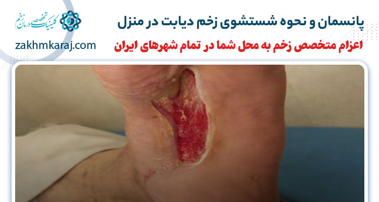 پانسمان و نحوه شستشوی زخم دیابت در منزل