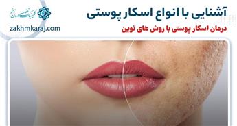 اسکار پوستی چیست و چه انواعی دارد؟