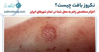 نکروز بافت بعد از عمل های زیبایی و روش های درمان آن