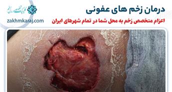 انواع  روش های درمان زخم عفونی شدید و خطرناک