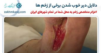 10 علت دیر خوب شدن زخم + روشهای درمان