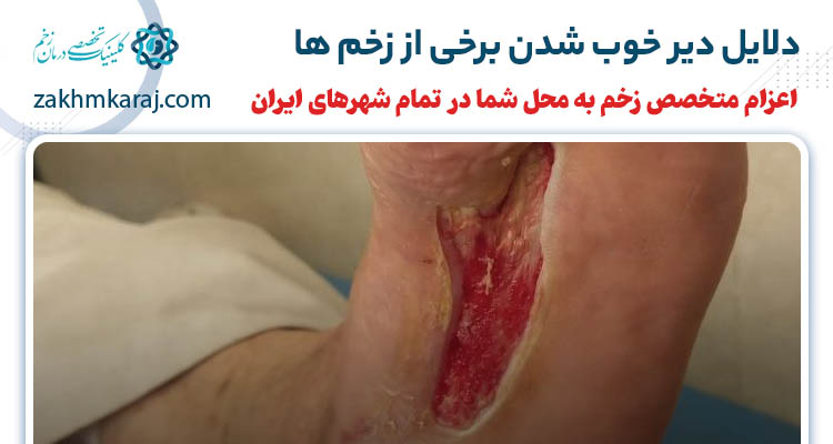 چرا برخی زخم ها دیر خوب می شوند؟