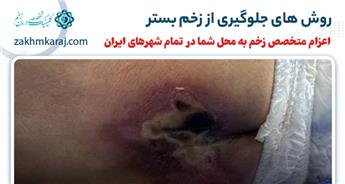 چگونه از به وجود آمدن زخم بستر جلوگیری کنیم؟