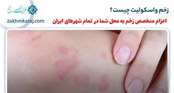 زخم واسکولیت چیست؟