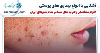 آشنایی با انواع بیماری های پوستی