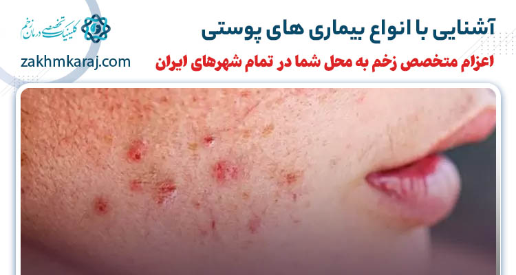 آشنایی با انواع بیماری های پوستی