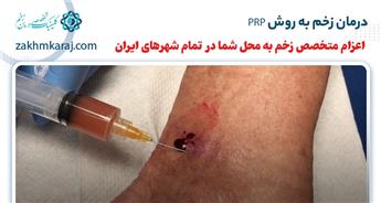 درمان زخم به روش PRP