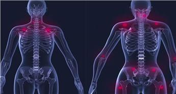 فیبرومیالژیا  چیست و چه علائمی دارد؟