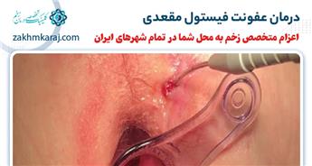 درمان عفونت فیستول مقعدی