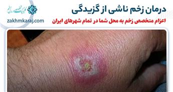درمان زخم ناشی از گزیدگی