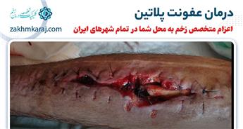 عفونت پلاتین چیست؟ آشنایی با علائم و روش های درمان آن