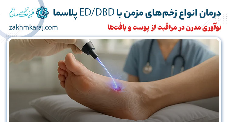 معرفی ED/DBD پلاسما