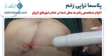 پلاسما تراپی زخم چیست و چه مزیتی دارد؟