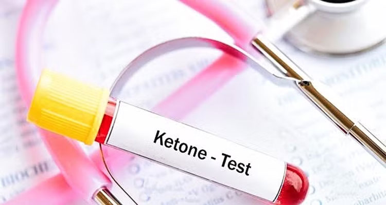 کتواسیدوز دیابتی