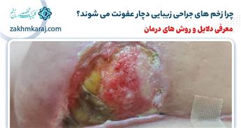 چرا زخم های جراحی زیبایی دچار عفونت می شوند؟