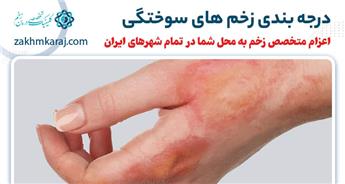 آشنایی با انواع درجه بندی زخم های سوختگی و نکات مهم