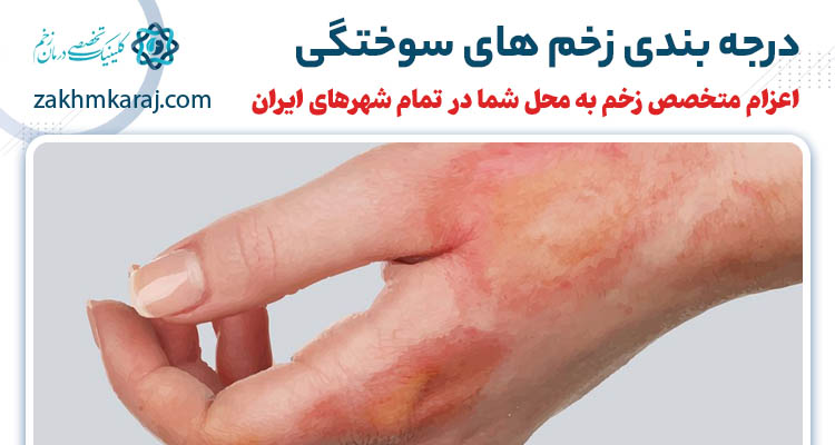 آشنایی با انواع درجه زخم سوختگی