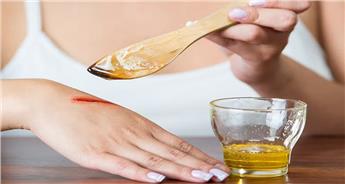 درمان زخم با عسل؛ بررسی علمی این روش و عوارض آن