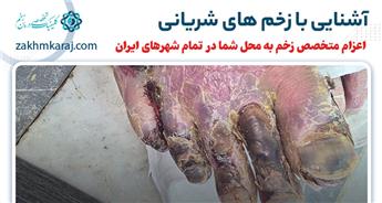 روش های درمان زخم های شریانی و عروقی