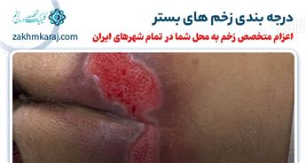 آشنایی با انواع درجه بندی زخم بستر