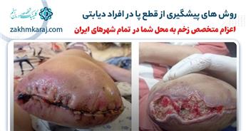 روش های پیشگیری از قطع پا در افراد دیابتی