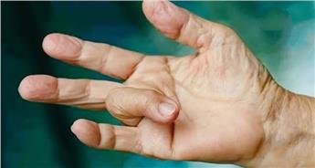 تریگر فینگر یا انگشت ماشه ای چیست و چه ارتباطی با افراد دیابتی دارد؟