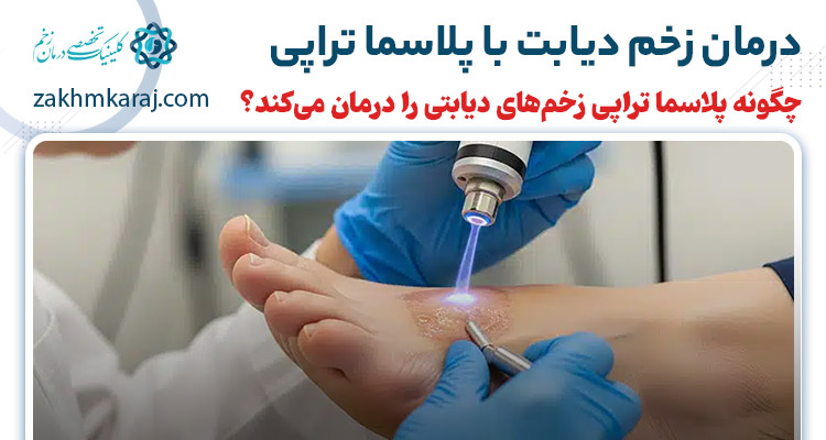 پلاسما تراپی زخم دیابت