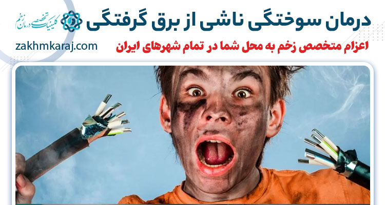 درمان زخم های ناشی از برق گرفتگی