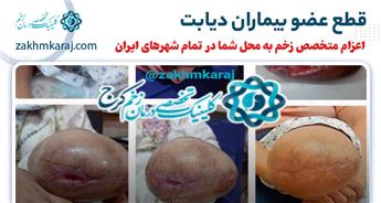 قطع عضو بیماران دیابت (دلایل و روش های پیشگیری)