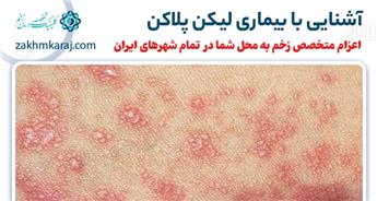 بیماری لیکن پلاکن چیست؟ آشنایی با خطرات و انواع آن و روش های درمان