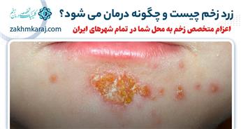 زرد زخم چیست؟ چه علائمی دارد؟ آشنایی با خطرات و روش های درمان آن