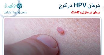 درمان زگیل تناسلی در کرج - کلینیک درمان HPV
