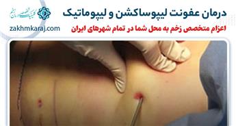 درمان عفونت لیپوساکشن و لیپوماتیک
